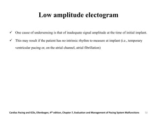 Low amplitude electogram
 One cause of undersensing is that of inadequate signal amplitude at the time of initial implant.
 This may result if the patient has no intrinsic rhythm to measure at implant (i.e., temporary
ventricular pacing or, on the atrial channel, atrial fibrillation)
Cardiac Pacing and ICDs, Ellenbogen, 4th edition, Chapter 7, Evaluation and Management of Pacing System Malfunctions 50
 