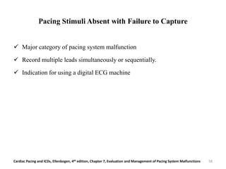 Pacing Stimuli Absent with Failure to Capture
 Major category of pacing system malfunction
 Record multiple leads simultaneously or sequentially.
 Indication for using a digital ECG machine
Cardiac Pacing and ICDs, Ellenbogen, 4th edition, Chapter 7, Evaluation and Management of Pacing System Malfunctions 58
 