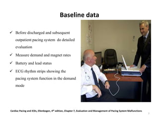 Baseline data
 Before discharged and subsequent
outpatient pacing system do detailed
evaluation
 Measure demand and magnet rates
 Battery and lead status
 ECG rhythm strips showing the
pacing system function in the demand
mode
Cardiac Pacing and ICDs, Ellenbogen, 4th edition, Chapter 7, Evaluation and Management of Pacing System Malfunctions
7
 