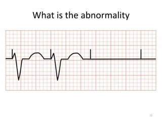 What is the abnormality
72
 