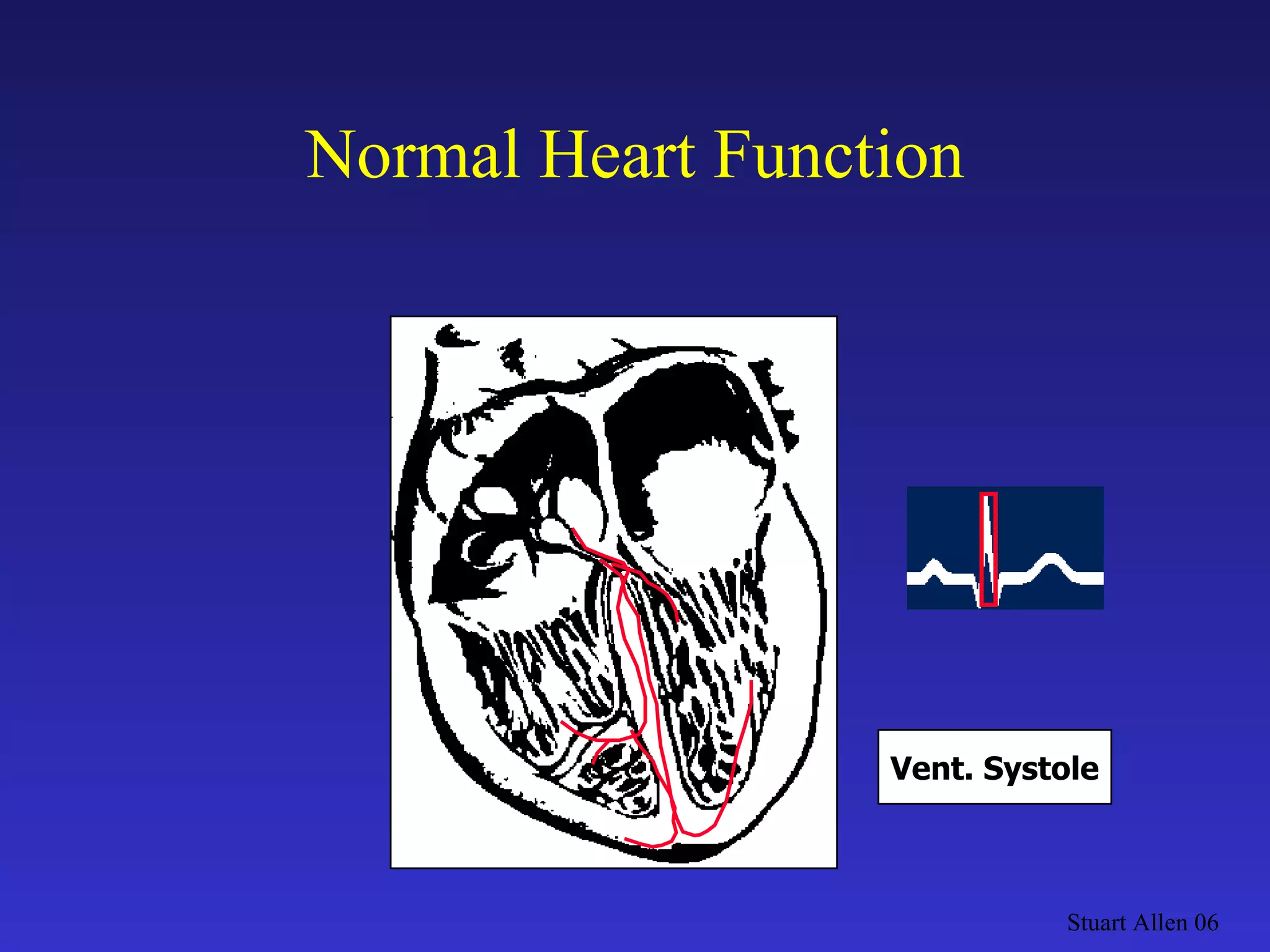 Normal Heart Function Stuart Allen 06 Vent. Systole 