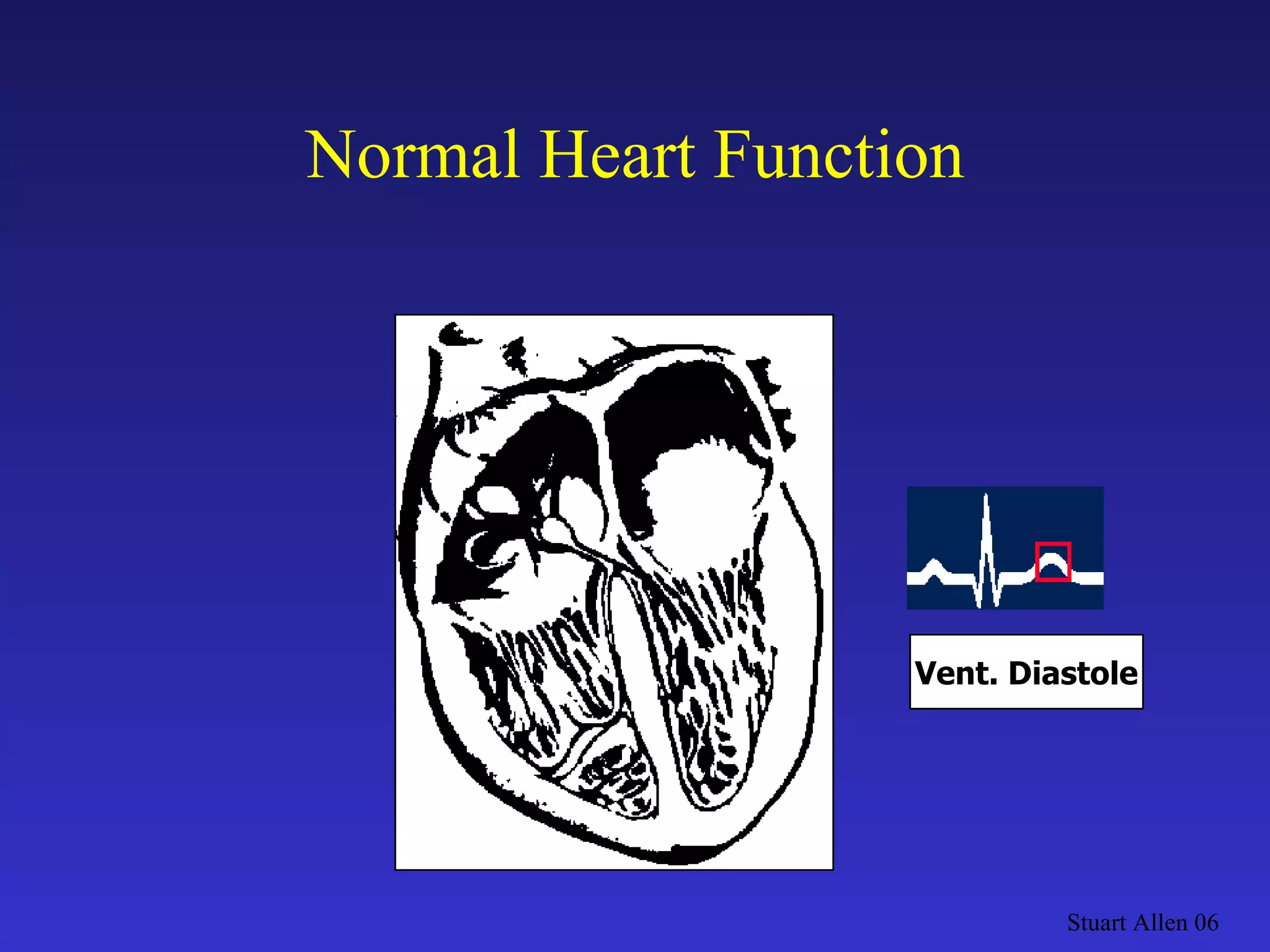 Normal Heart Function Stuart Allen 06 Vent. Diastole 