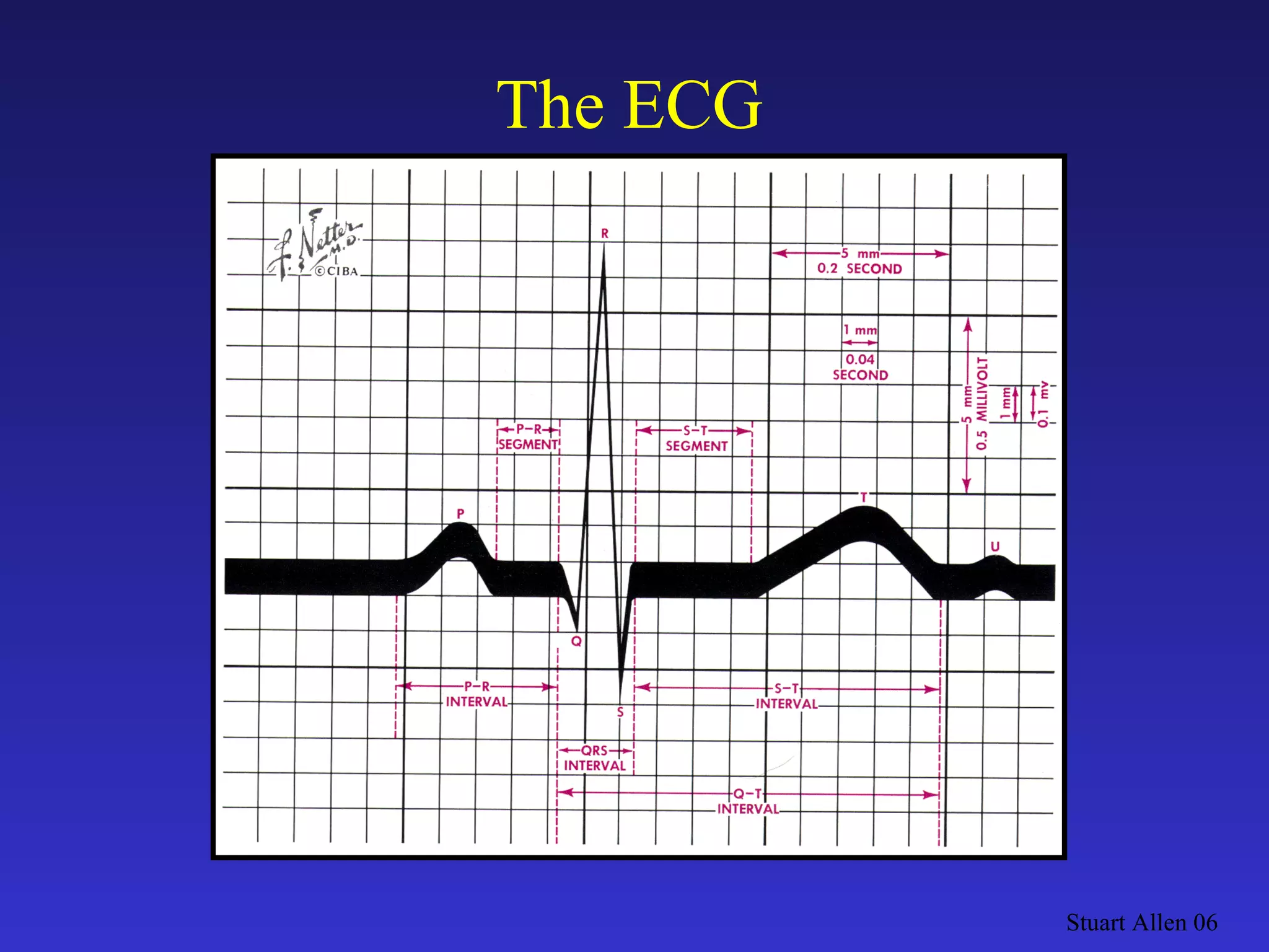 Stuart Allen 06 The ECG 