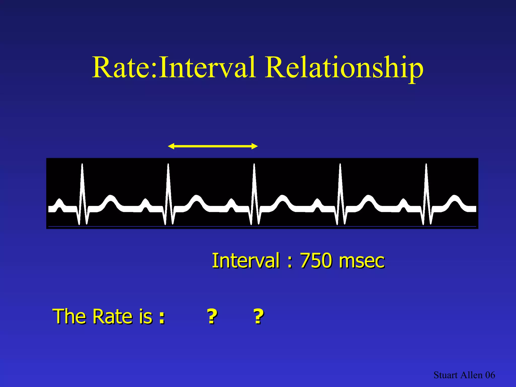 Rate:Interval Relationship Stuart Allen 06 The Rate is  :  ?  ?  Interval : 750 msec 