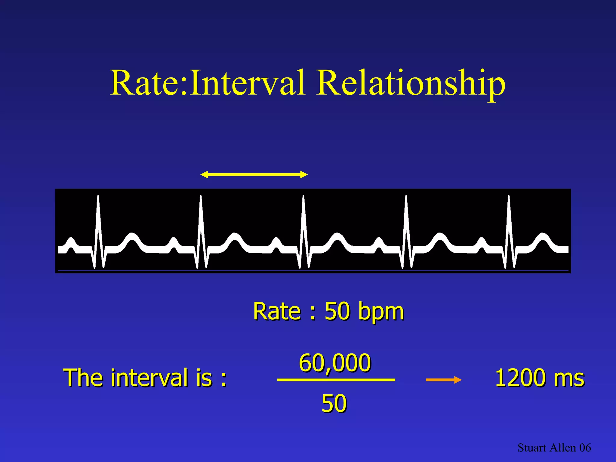Stuart Allen 06 The interval is : 50 Rate : 50 bpm   60,000 1200 ms Rate:Interval Relationship 