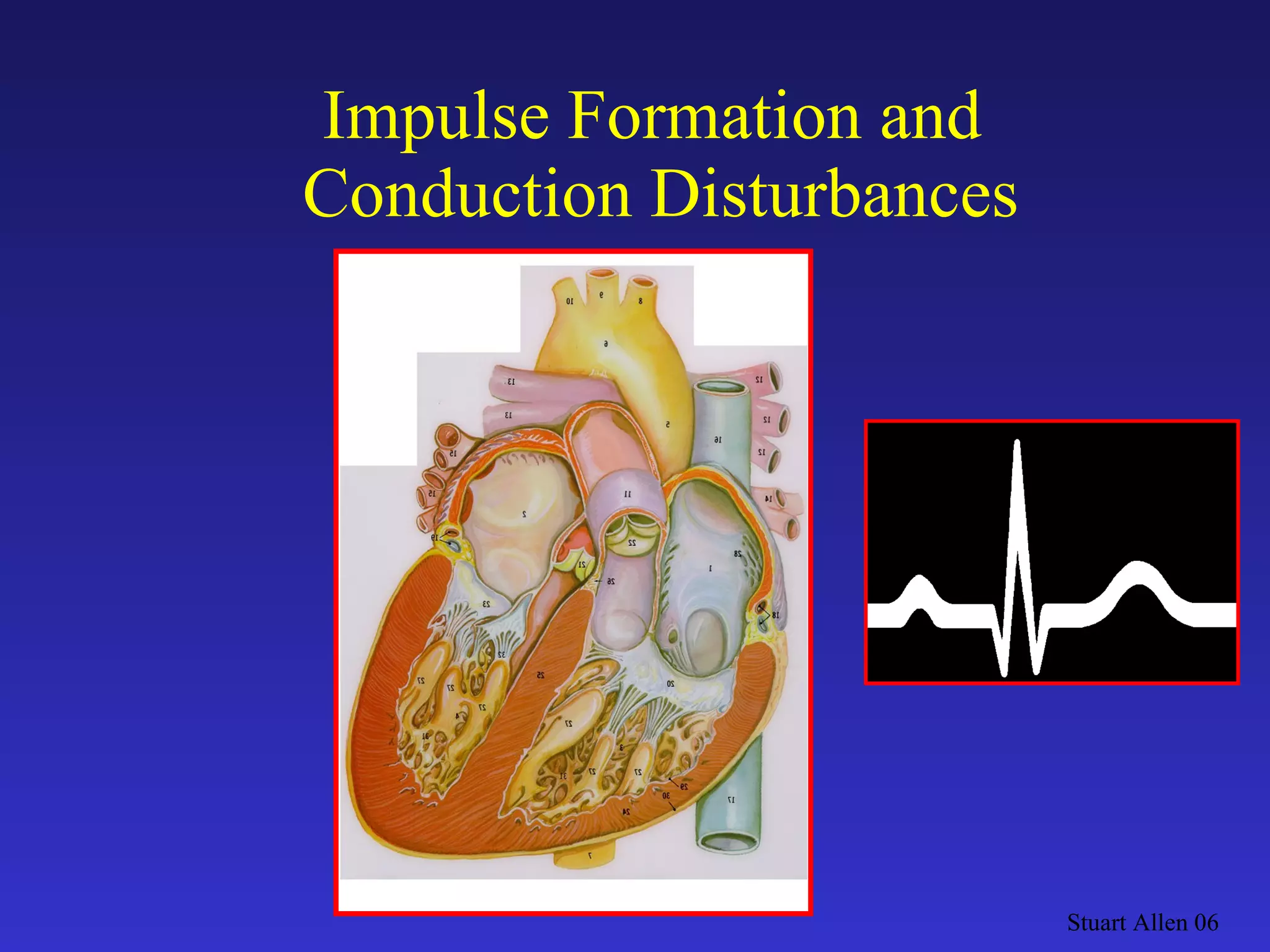 Impulse Formation and  Conduction Disturbances Stuart Allen 06 