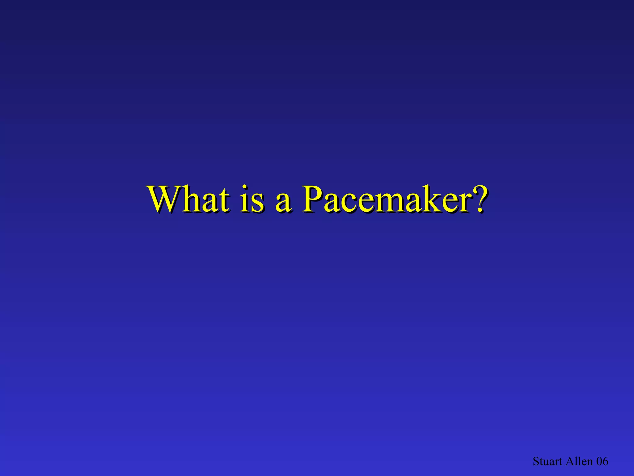 What is a Pacemaker? Stuart Allen 06 