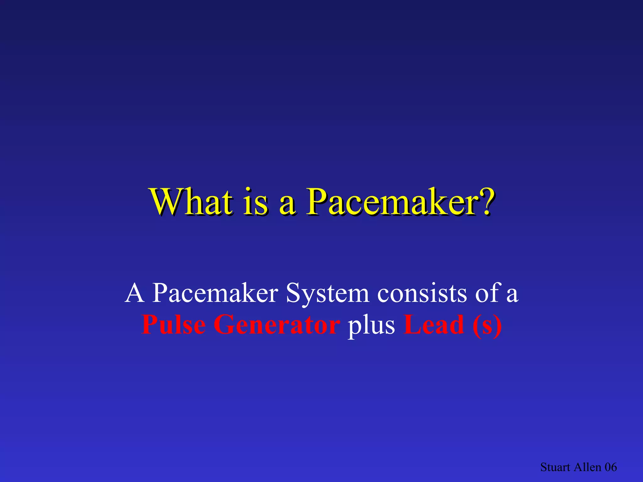 What is a Pacemaker? A Pacemaker System consists of a  Pulse Generator  plus  Lead (s) Stuart Allen 06 