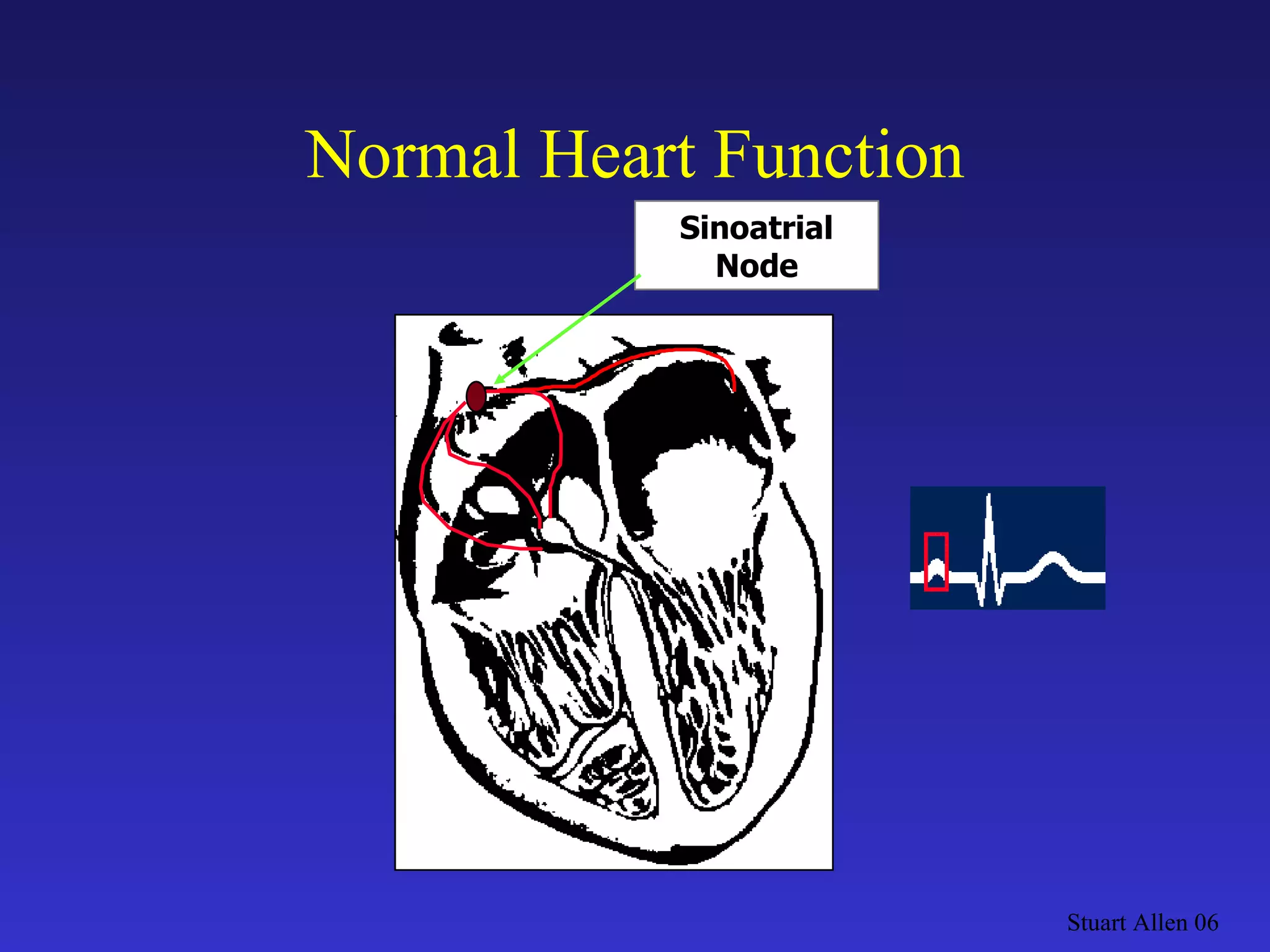 Normal Heart Function Stuart Allen 06 Sinoatrial Node 