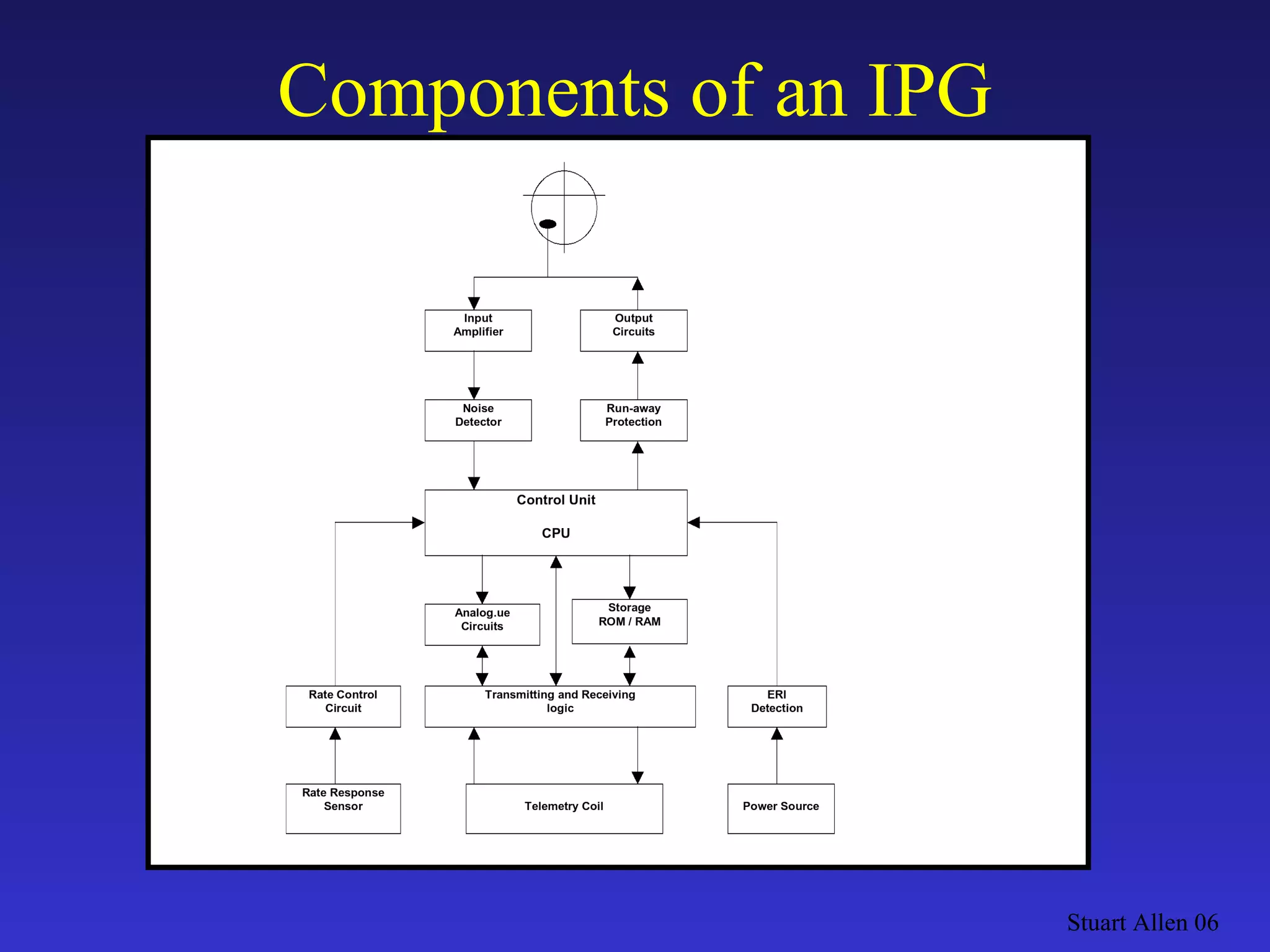 Stuart Allen 06 Components of an IPG 