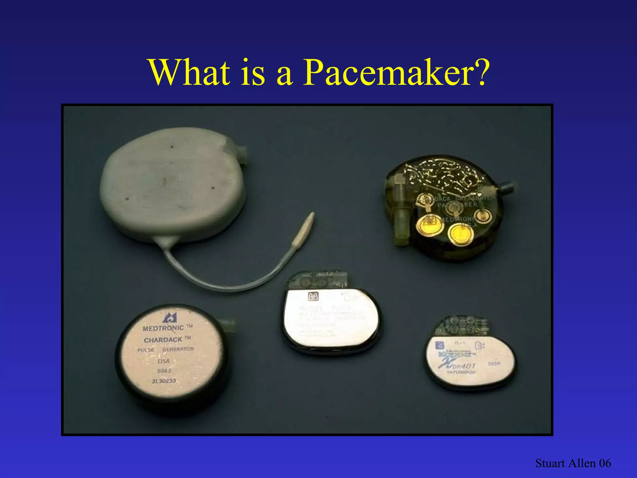 What is a Pacemaker? Stuart Allen 06 