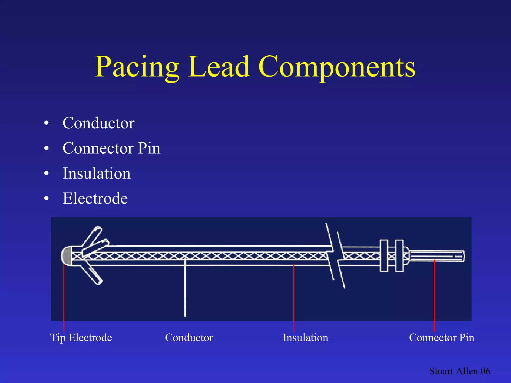 Pacing Lead Components Conductor  Connector Pin Insulation Electrode Stuart Allen 06 Conductor  Tip Electrode Insulation Connector Pin 