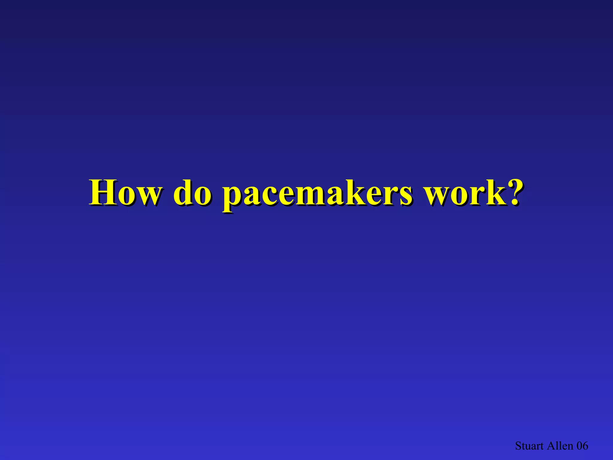 How do pacemakers work? Stuart Allen 06 
