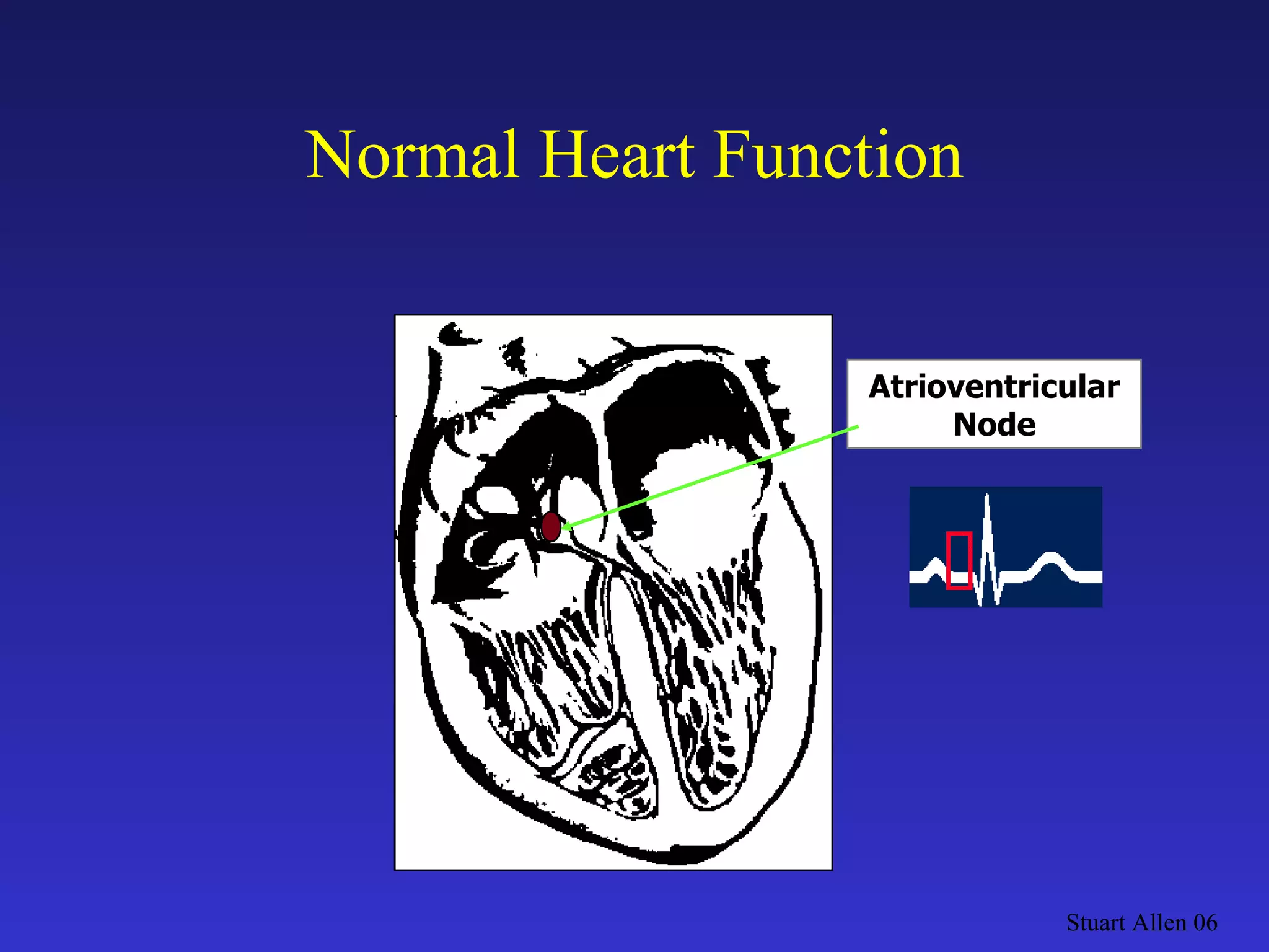 Normal Heart Function Stuart Allen 06 Atrioventricular Node 