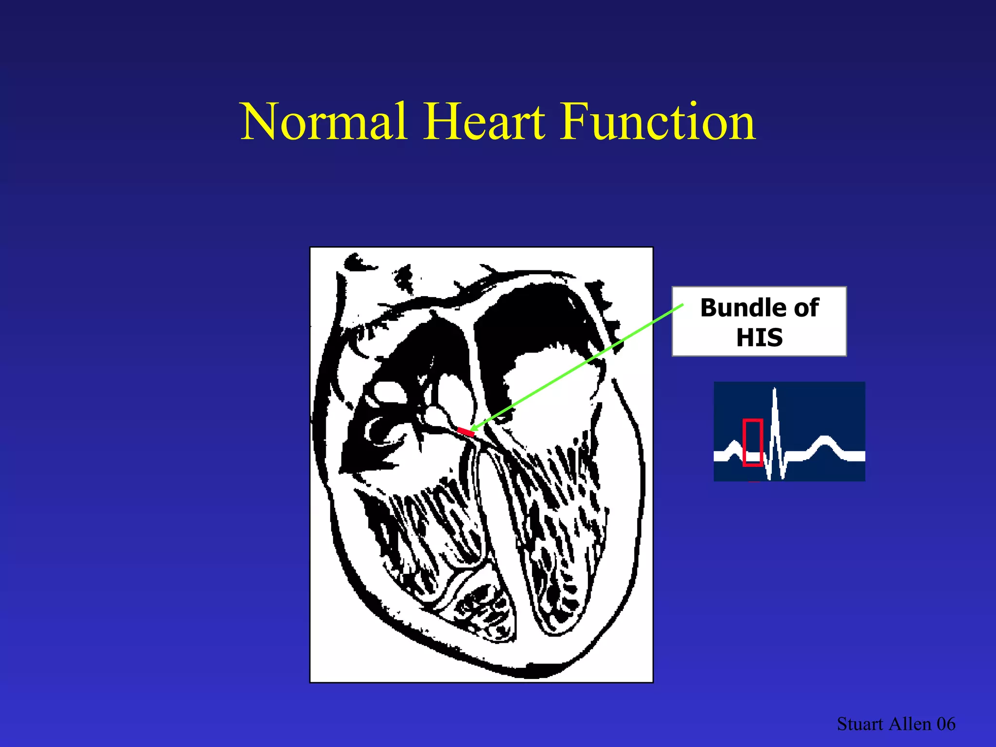 Normal Heart Function Stuart Allen 06 Bundle of HIS 