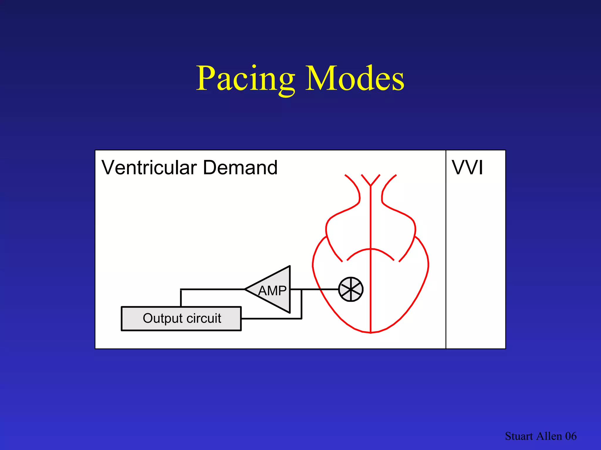 Pacing Modes Stuart Allen 06 Output circuit VVI AMP Ventricular Demand 