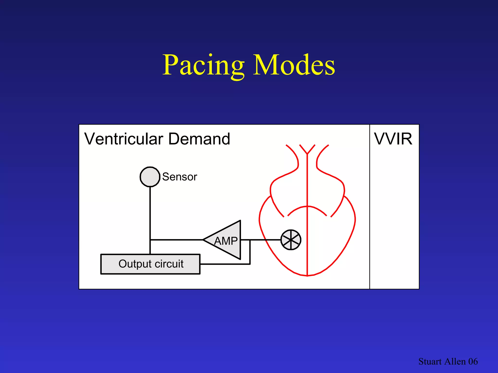 Pacing Modes Stuart Allen 06 Output circuit VVIR AMP Sensor Ventricular Demand 