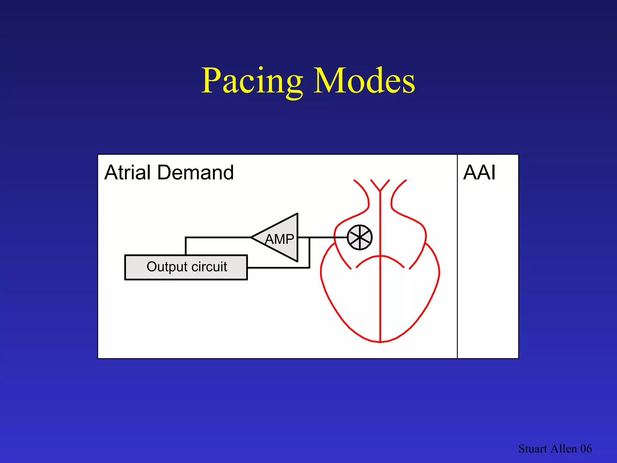 Pacing Modes Stuart Allen 06 Output circuit AAI AMP Atrial Demand 
