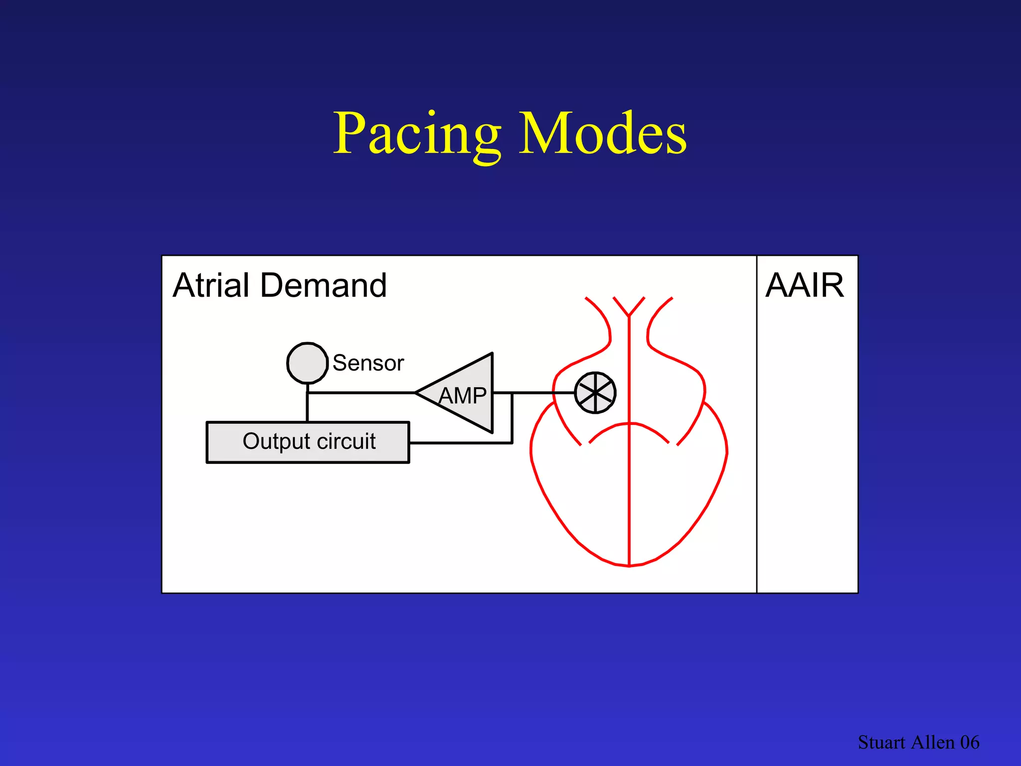 Pacing Modes Stuart Allen 06 Output circuit AAIR AMP Atrial Demand Sensor 