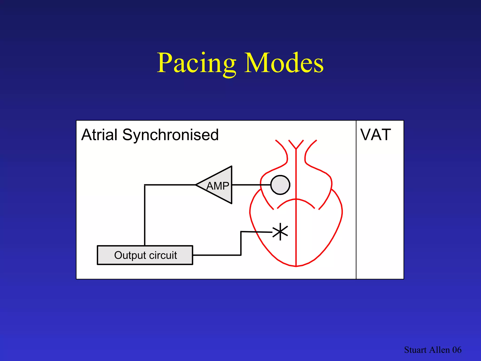 Pacing Modes Stuart Allen 06 Output circuit VAT AMP Atrial Synchronised 