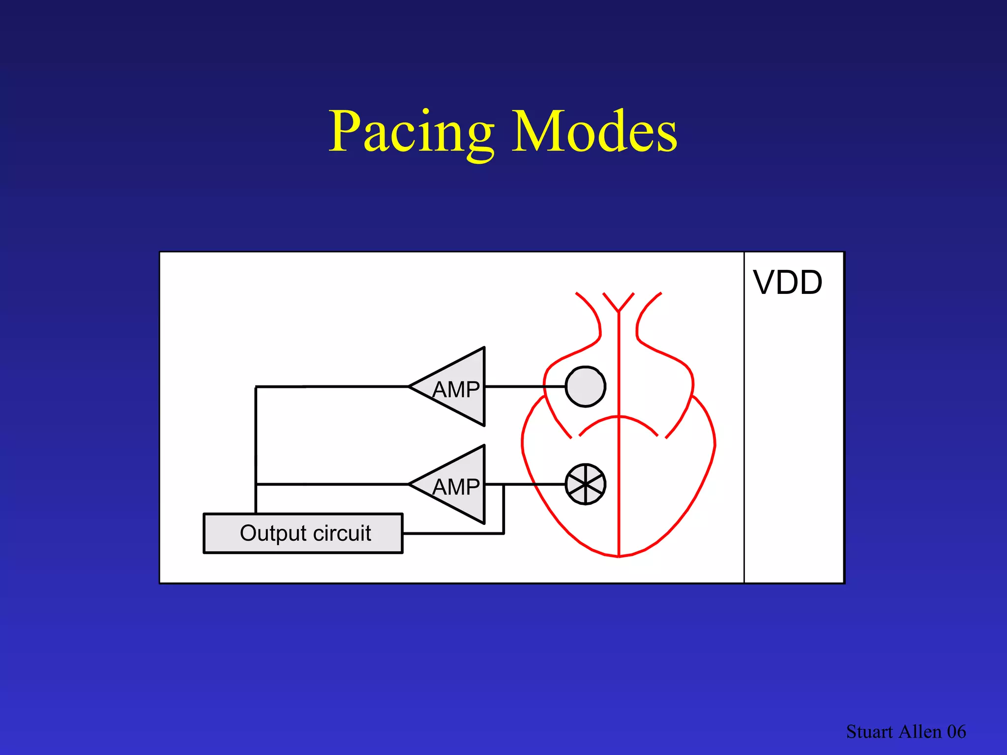 Pacing Modes Stuart Allen 06 Output circuit DVI AMP A-V Sequential Output circuit Output circuit VDD AMP AMP 