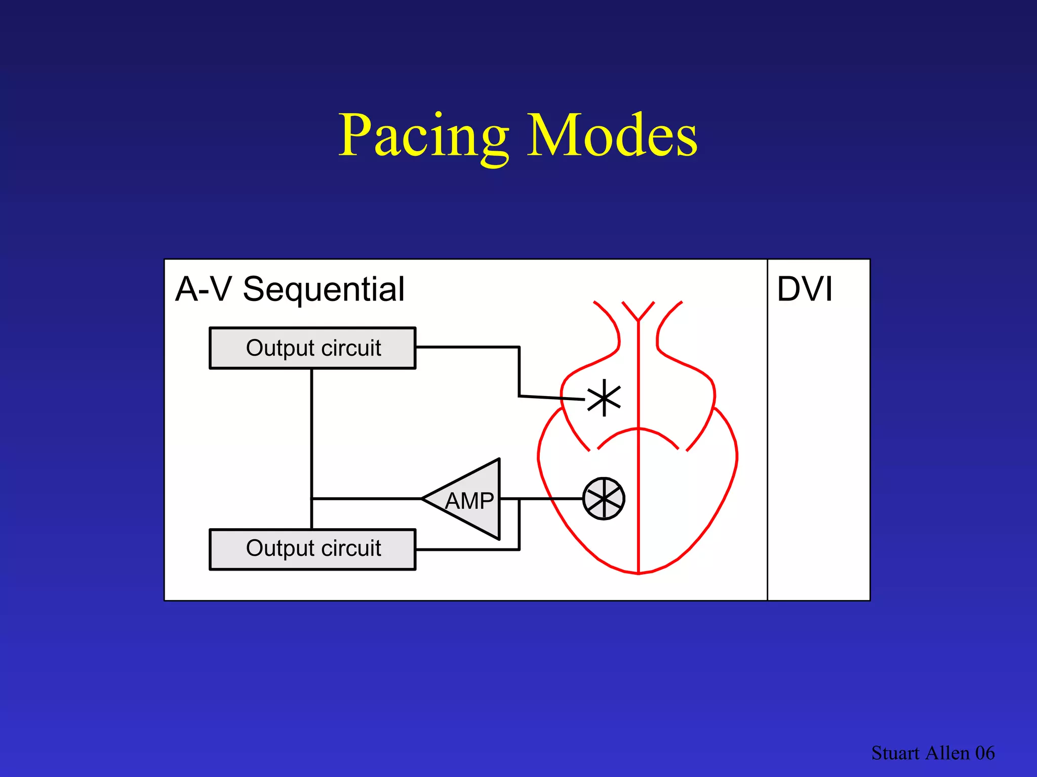 Pacing Modes Stuart Allen 06 Output circuit DVI AMP A-V Sequential Output circuit 