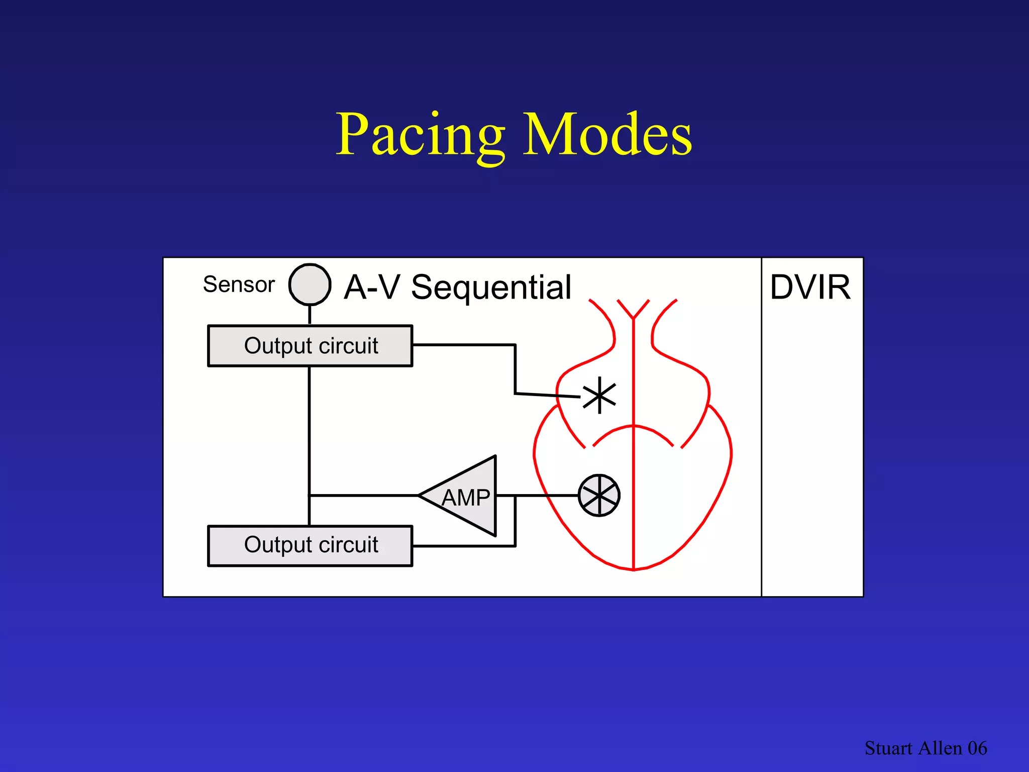 Pacing Modes Stuart Allen 06 Output circuit DVIR AMP A-V Sequential Output circuit Sensor 