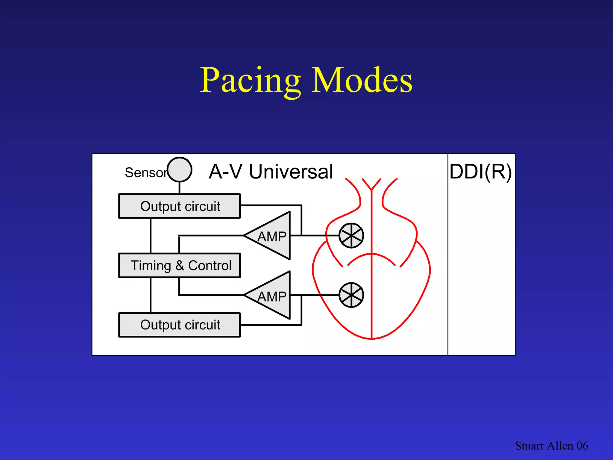 Pacing Modes Stuart Allen 06 Output circuit DDI(R) AMP Output circuit Timing & Control AMP A-V Universal Sensor 