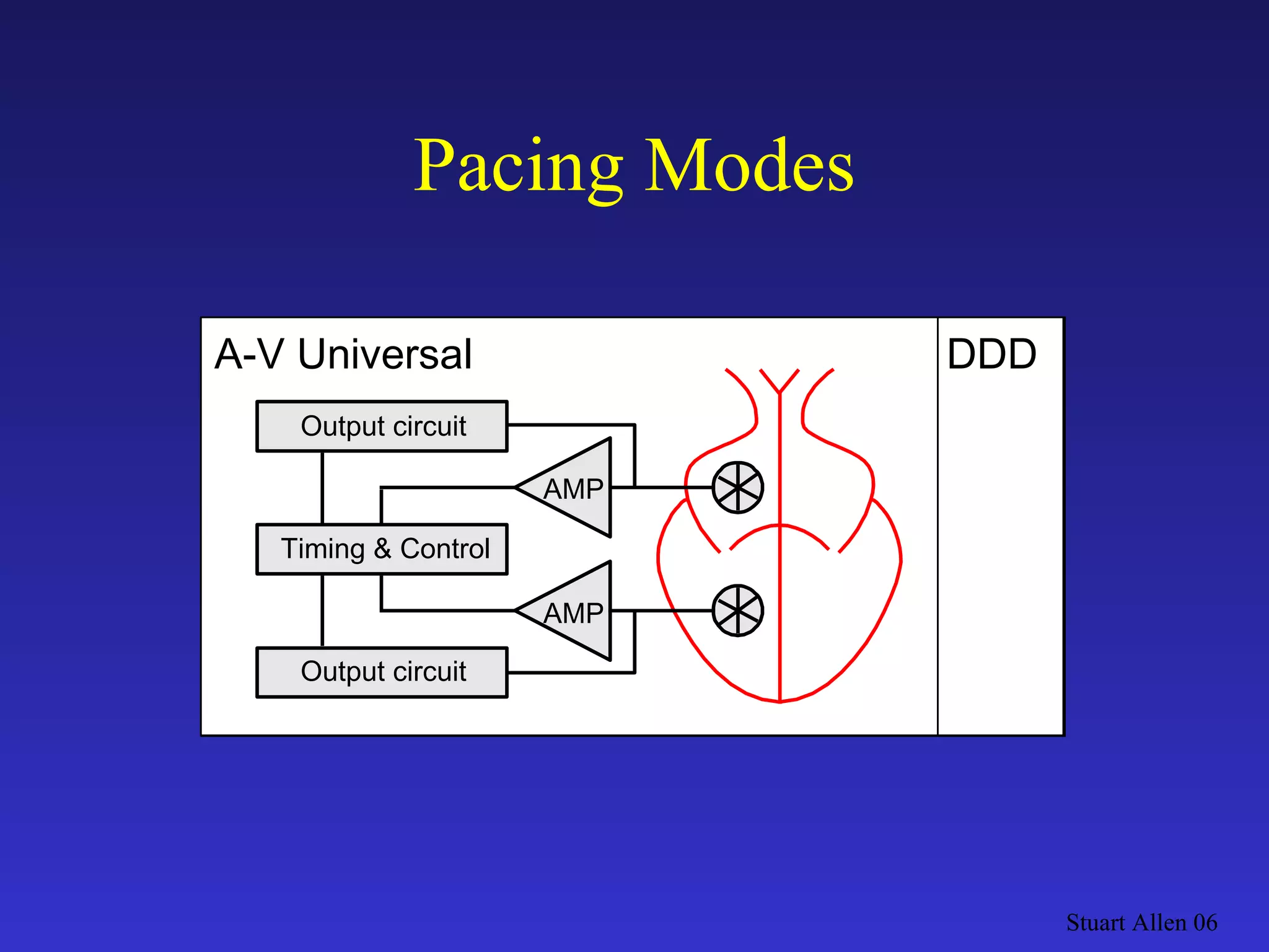 Pacing Modes Stuart Allen 06 Output circuit DVI AMP A-V Sequential Output circuit Output circuit DDD AMP A-V Universal Output circuit Timing & Control AMP 