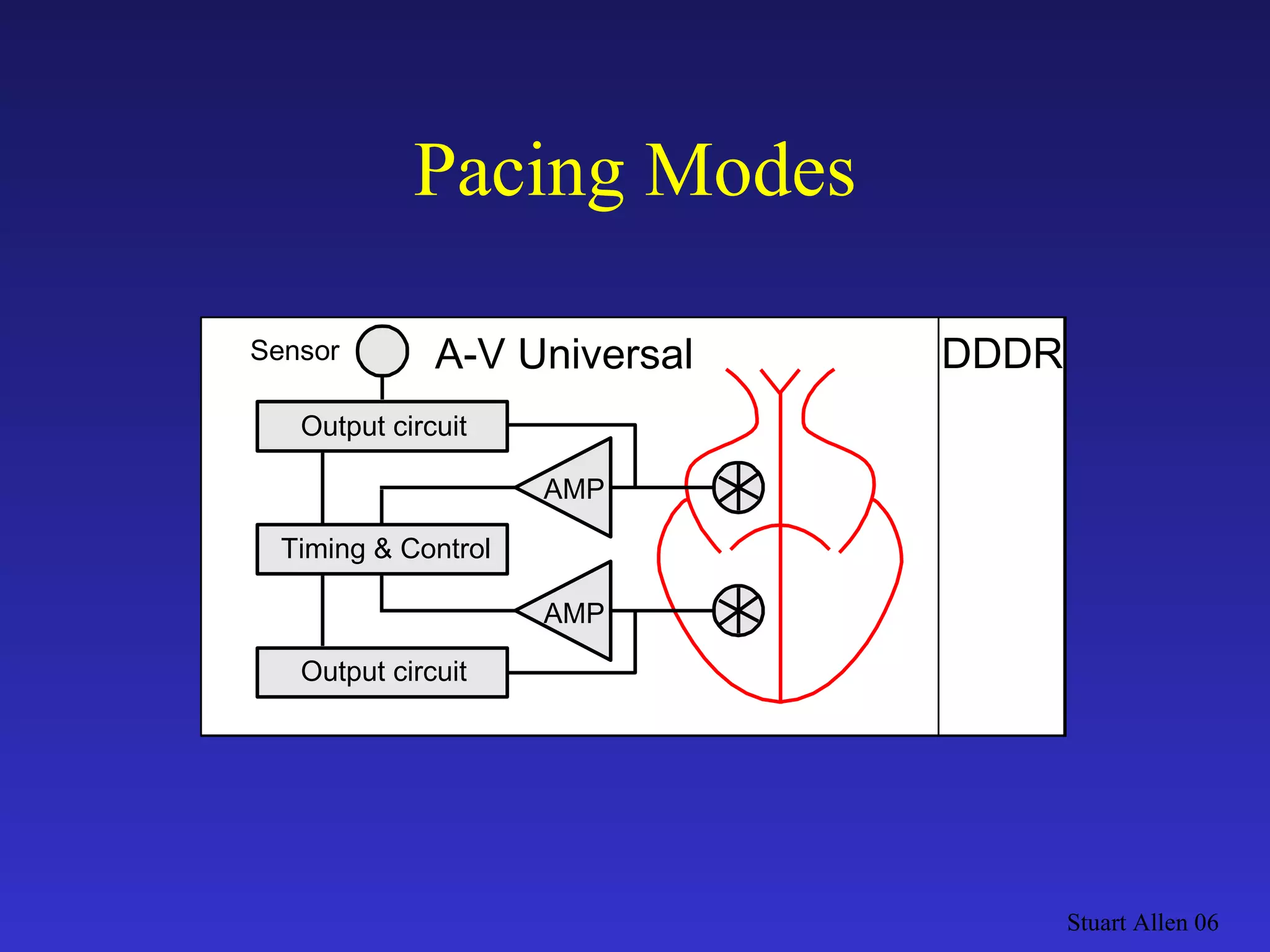 Stuart Allen 06 Pacing Modes Output circuit DVI AMP A-V Sequential Output circuit Output circuit DDDR AMP A-V Universal Output circuit Timing & Control AMP Sensor 