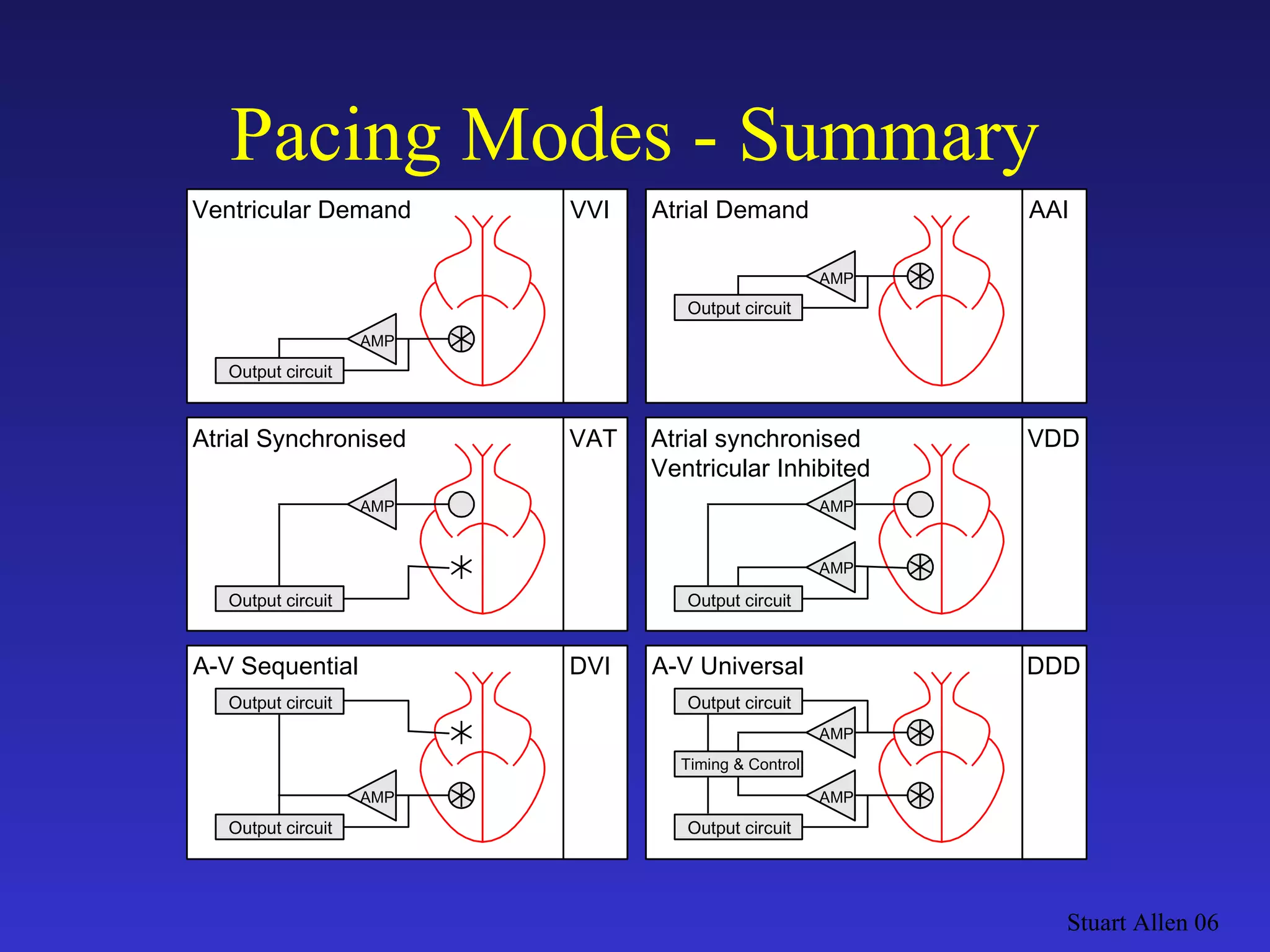 Pacing Modes - Summary Stuart Allen 06 Output circuit VVI AMP Ventricular Demand Output circuit VAT AMP Atrial Synchronised Output circuit AAI AMP Atrial Demand Output circuit DVI AMP A-V Sequential Output circuit Output circuit VDD AMP Atrial synchronised Ventricular Inhibited AMP Output circuit DDD AMP A-V Universal Output circuit Timing & Control AMP 
