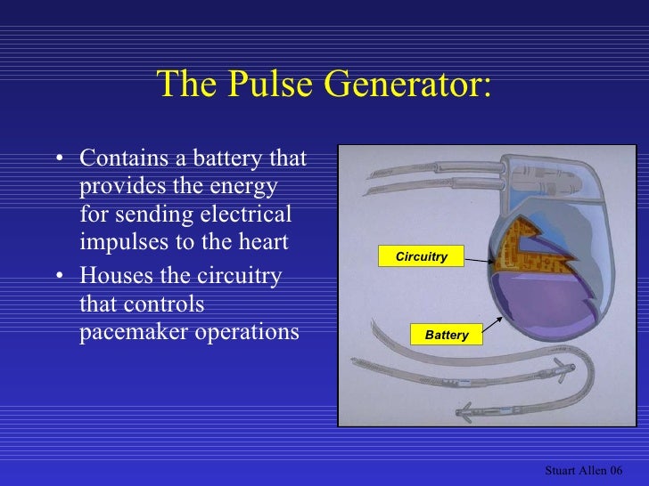 Pacemaker Overview