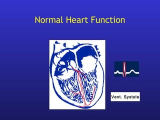 Normal Heart Function
Vent. Systole
 