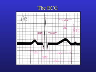 The ECG
 