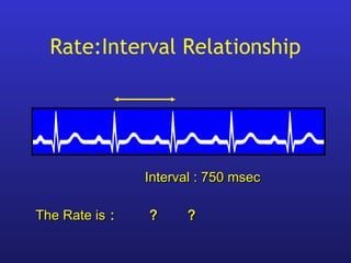 The Rate isThe Rate is : ? ?: ? ?
Interval : 750 msecInterval : 750 msec
Rate:Interval Relationship
 
