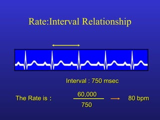 The Rate isThe Rate is ::
750750
Interval : 750 msecInterval : 750 msec
60,00060,000
80 bpm80 bpm
Rate:Interval Relationship
 