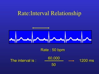 The interval is :The interval is :
5050
Rate : 50 bpmRate : 50 bpm
60,00060,000
1200 ms1200 ms
Rate:Interval Relationship
 