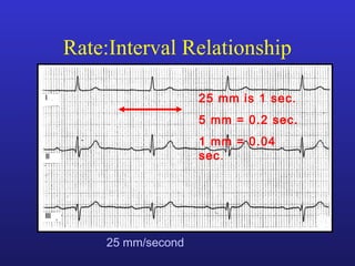 25 mm is 1 sec.
5 mm = 0.2 sec.
1 mm = 0.04
sec.
25 mm/second
Rate:Interval Relationship
 