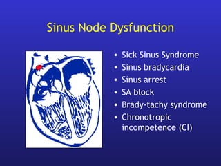 Sinus Node Dysfunction
• Sick Sinus Syndrome
• Sinus bradycardia
• Sinus arrest
• SA block
• Brady-tachy syndrome
• Chronotropic
incompetence (CI)
 