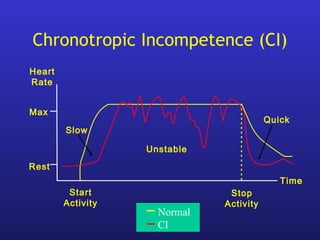 Chronotropic Incompetence (CI)
Max
Rest
Heart
Rate
Time
Start
Activity
Stop
Activity
Quick
Unstable
Slow
Normal
CI
 