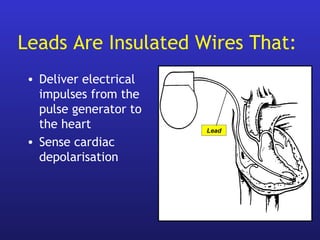• Deliver electrical
impulses from the
pulse generator to
the heart
• Sense cardiac
depolarisation
Lead
Leads Are Insulated Wires That:
 