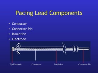 ConductorTip Electrode Insulation Connector Pin
Pacing Lead Components
• Conductor
• Connector Pin
• Insulation
• Electrode
 