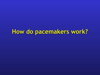 How do pacemakers work?How do pacemakers work?
 