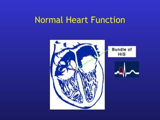 Bundle of
HIS
Normal Heart Function
 