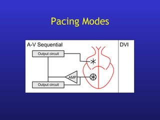 Output circuit
DVI
AMP
A-V Sequential
Output circuit
Pacing Modes
 