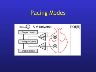 Output circuit
DDI(R)
AMP
Output circuit
Timing & Control
AMP
A-V UniversalSensor
Pacing Modes
 