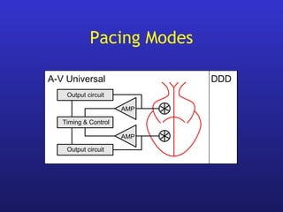 Output circuit
DVI
AMP
A-V Sequential
Output circuit
Output circuit
DDD
AMP
A-V Universal
Output circuit
Timing & Control
AMP
Pacing Modes
 