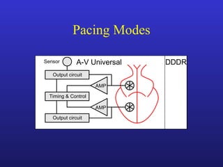 Output circuit
DVI
AMP
A-V Sequential
Output circuit
Output circuit
DDDR
AMP
A-V Universal
Output circuit
Timing & Control
AMP
Sensor
Pacing Modes
 