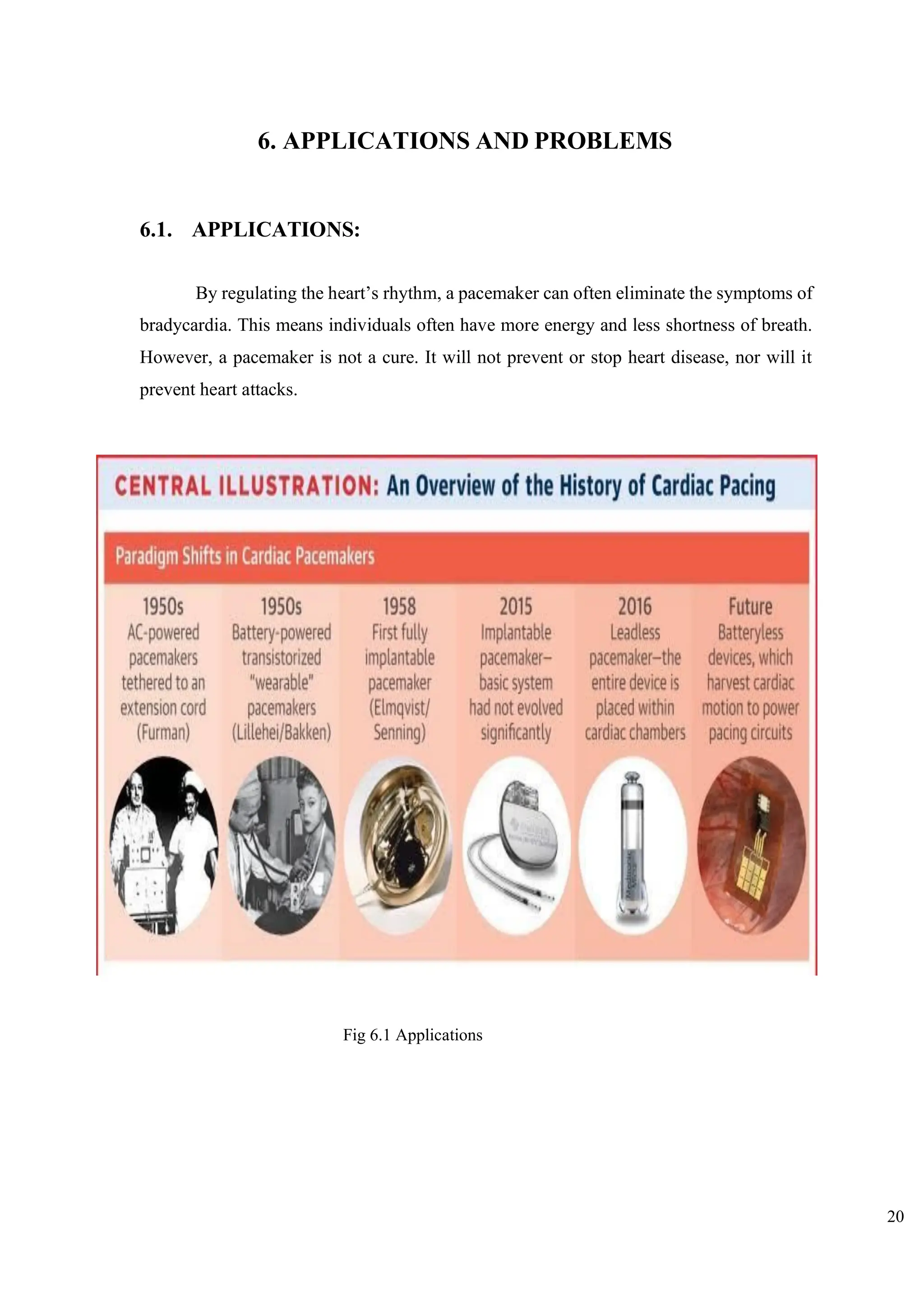 20
6. APPLICATIONS AND PROBLEMS
6.1. APPLICATIONS:
By regulating the heart’s rhythm, a pacemaker can often eliminate the symptoms of
bradycardia. This means individuals often have more energy and less shortness of breath.
However, a pacemaker is not a cure. It will not prevent or stop heart disease, nor will it
prevent heart attacks.
Fig 6.1 Applications
 