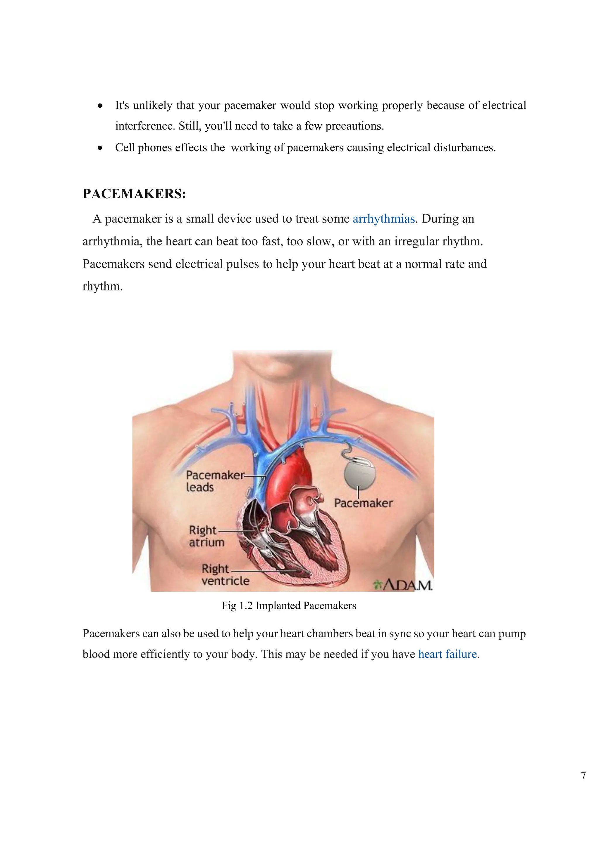 7
• It's unlikely that your pacemaker would stop working properly because of electrical
interference. Still, you'll need to take a few precautions.
• Cell phones effects the working of pacemakers causing electrical disturbances.
PACEMAKERS:
A pacemaker is a small device used to treat some arrhythmias. During an
arrhythmia, the heart can beat too fast, too slow, or with an irregular rhythm.
Pacemakers send electrical pulses to help your heart beat at a normal rate and
rhythm.
Pacemakers can also be used to help your heart chambers beat in sync so your heart can pump
blood more efficiently to your body. This may be needed if you have heart failure.
Fig 1.2 Implanted Pacemakers
 